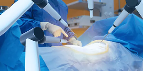 Surgery robotic machine helps doctor to perform a complex procedure with more precision, flexibility and control than is possible