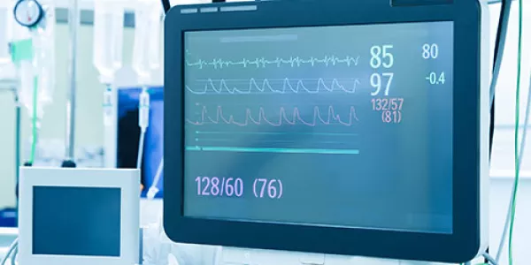 Functional vital functions (vital signs) monitor in an operating room with machines in the background, during surgery on a patient.