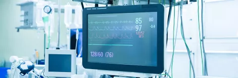 Functional vital functions (vital signs) monitor in an operating room with machines in the background, during surgery on a patient.